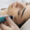microneedling